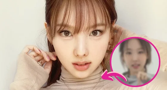 Maybe That’s One of Her Insecurities? – Netizens React to the Speculations That Nayeon Had Her Bunny Teeth Removed